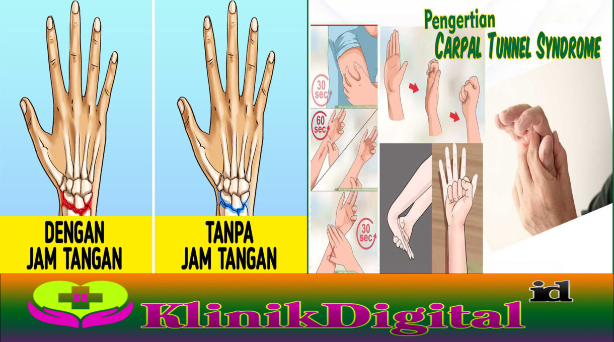 Sindrom Lorong Karpal, Kelainan Saraf Pergelangan Tangan