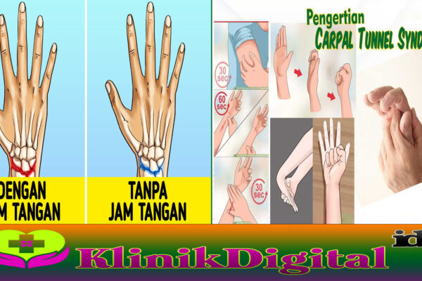 Sindrom Lorong Karpal, Kelainan Saraf Pergelangan Tangan