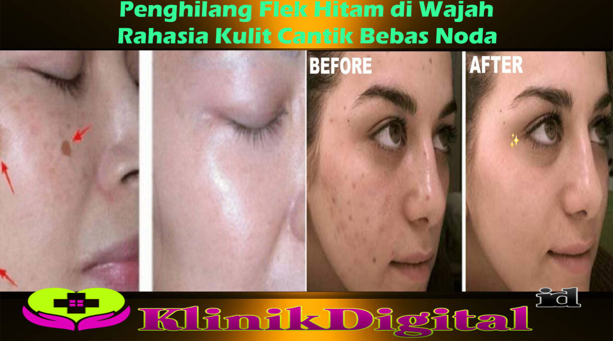 Rahasia Kulit Cantik Bebas Noda