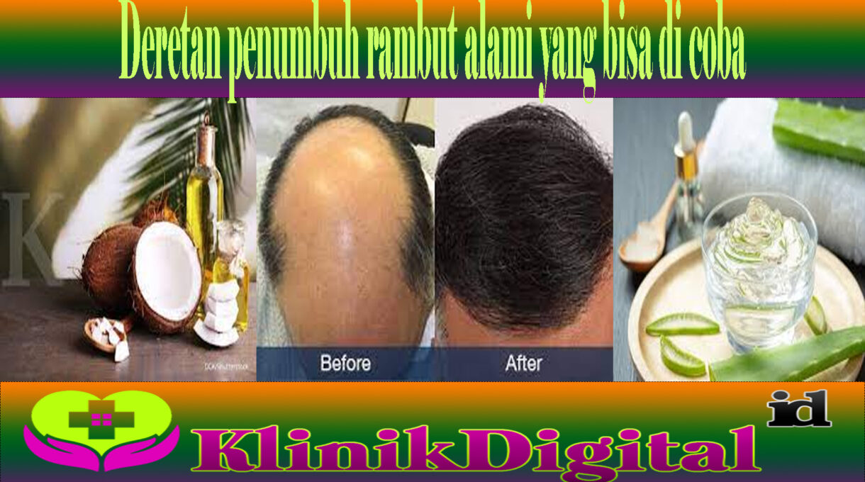 Deretan penumbuh rambut alami yang bisa di coba 