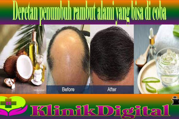 Deretan penumbuh rambut alami yang bisa di coba 