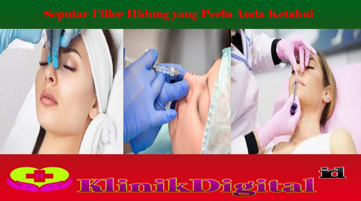 Seputar Filler Hidung yang Perlu Anda Ketahui