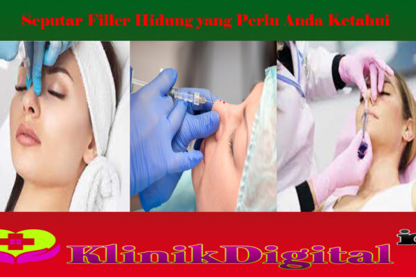 Seputar Filler Hidung yang Perlu Anda Ketahui