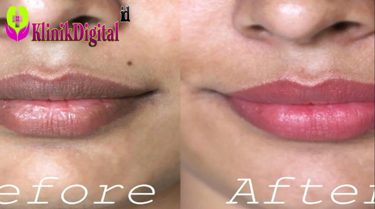 5 Cara Memerahkan Bibir secara Alami dengan Mudah