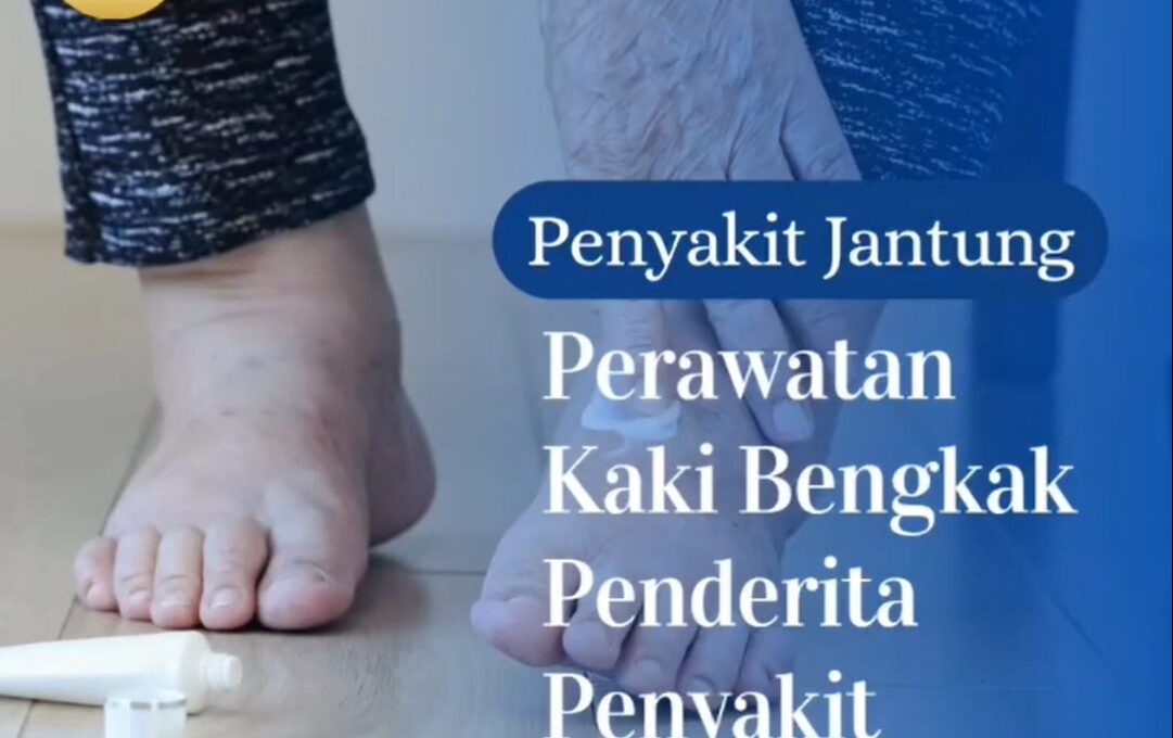 Apa Saja Tanda Kerusakan Jantung yang Bisa Dilihat dari Kaki, Termasuk Bentuk dan Warnanya
