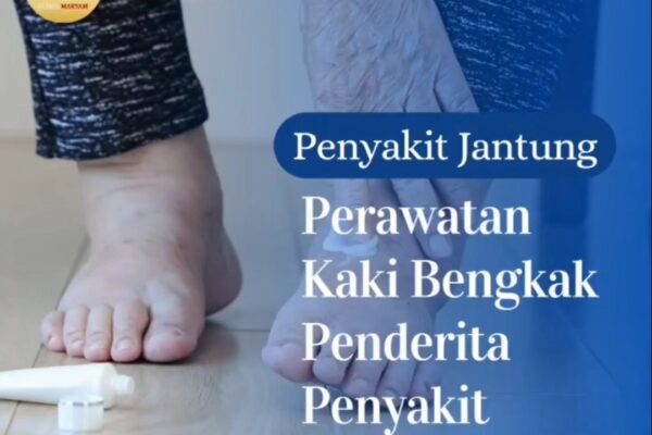Apa Saja Tanda Kerusakan Jantung yang Bisa Dilihat dari Kaki, Termasuk Bentuk dan Warnanya